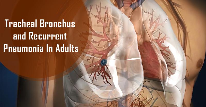 <p>Evaluation and Management of Tracheal Bronchus and Recurrent Pneumonia In Adults</p>