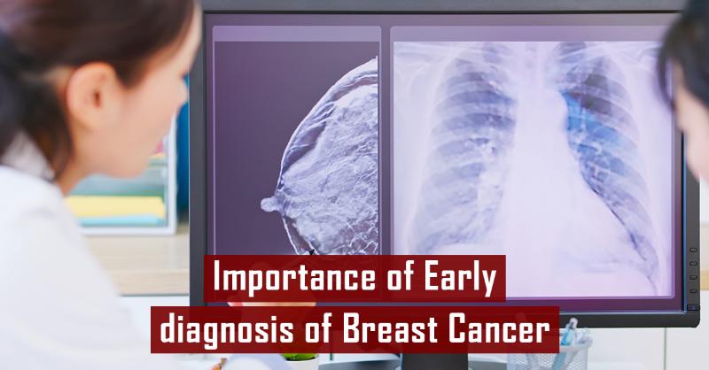 <p>Guiding Early Breast Cancer Care: ESMO Clinical Practice Guidelines</p>