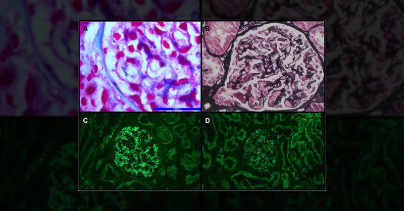 Diagnosis of Malaise and Erythematous Rash in a 36-Year-Old Woman ...