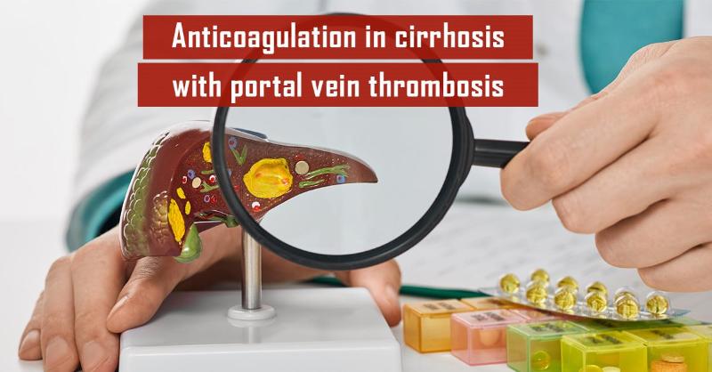 <p>All-Cause Mortality Reduction with Anticoagulation in Patients with Cirrhosis and Portal Vein Thrombosis: A Long-Term Analysis</p>