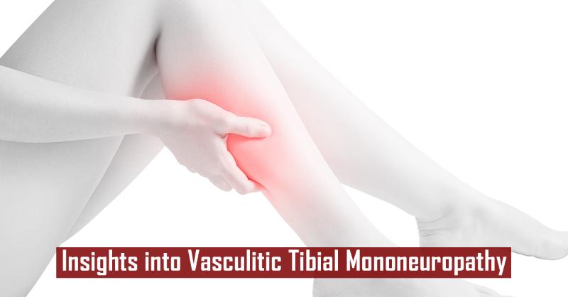 Vasculitic Tibial Mononeuropathy in a 28 year old female 