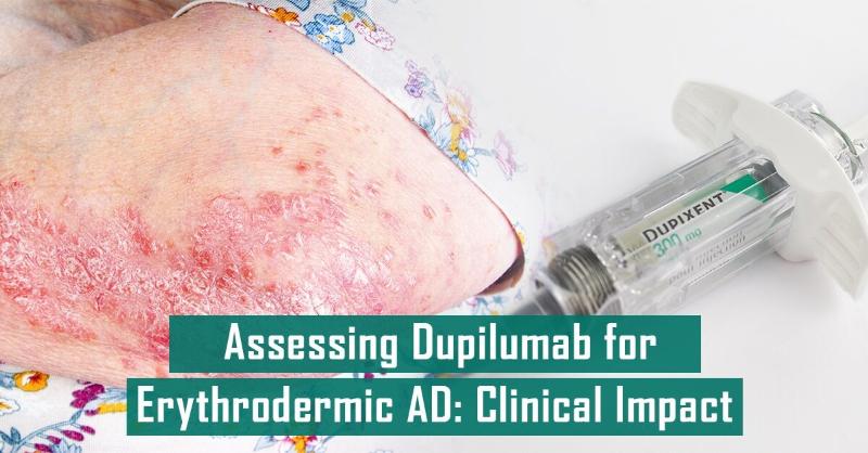 <p>Efficacy and Safety of Dupilumab for Erythrodermic Atopic Dermatitis?</p>