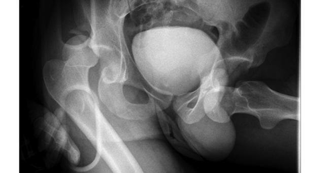 Patient with Respiratory Distress