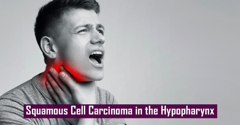 Squamous Cell Carcinoma in the Hypopharynx