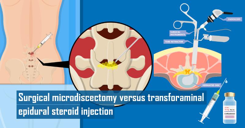 Surgical Microdiscectomy versus Transforaminal Epidural Steroid Injection