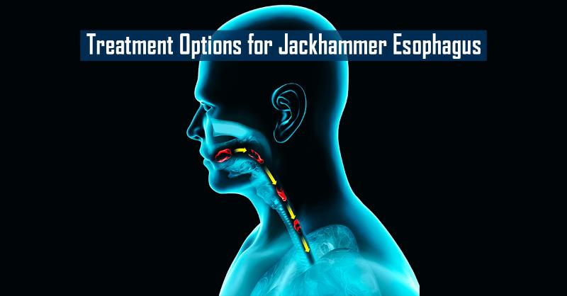 Your Opinion on Suitable Treatments for Jackhammer Esophagus