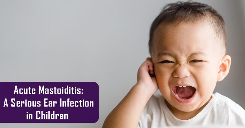 <p>The Complications of Acute Mastoiditis in Children</p>