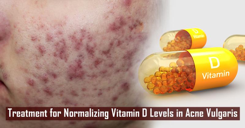 Snapshot of Importance Of Vitamin D To Acne