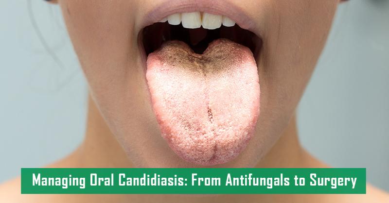 Effective Management Strategies for Oral Thrush in Clinical Practice
