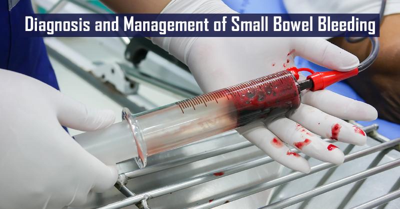 Diagnosis and Management of Small Bowel Bleeding