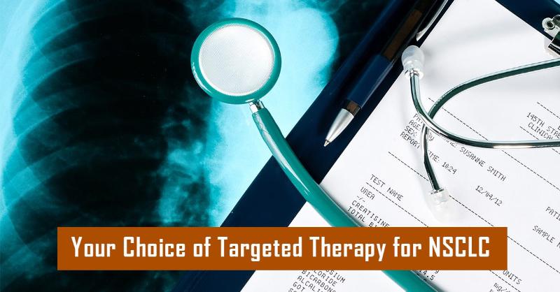 <p>Choosing the Right Therapy for Non-Small Cell Lung Cancer</p>