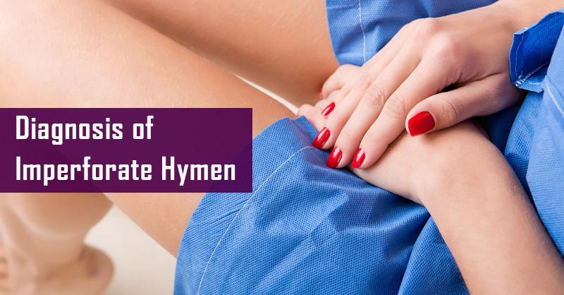 <p>Diagnosis of Imperforate Hymen: Identifying a Congenital Anomaly</p>