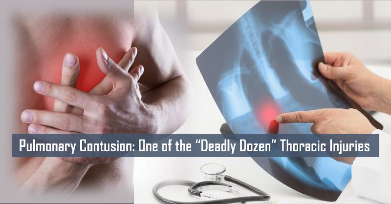 Clinical Presentation, Diagnosis, and Management of Pulmonary Contusions