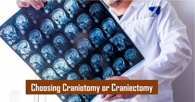 <p>Factors Influencing the Decision between Craniotomy and Decompressive Craniectomy</p>