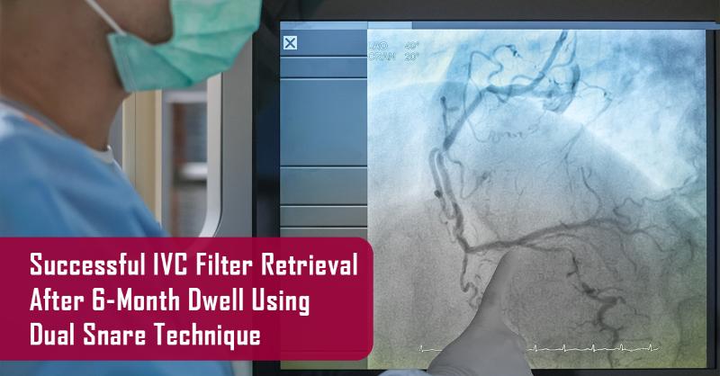 Single-Access Dual-Snare Technique for Embedded Inferior Vena Cava Filter Retrieval