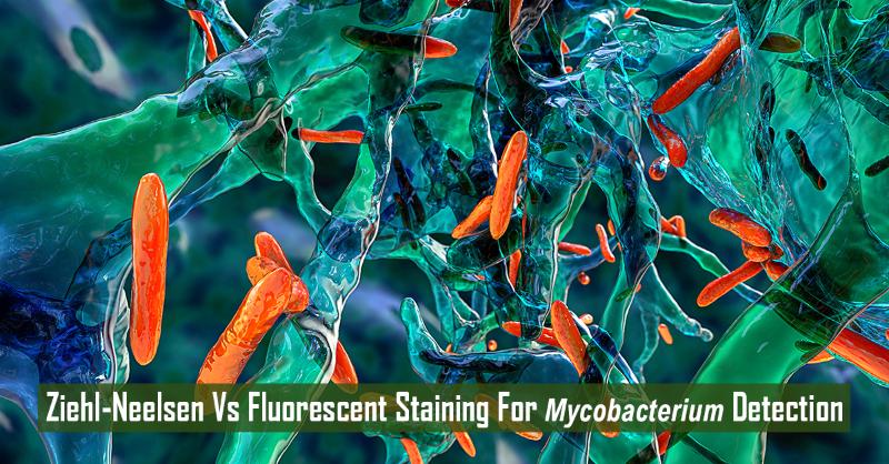 Comparison of Ziehl - Neelsen (ZN) Staining and Fluorescent (FL) Staining in Suspected Cases of Tuberculosis