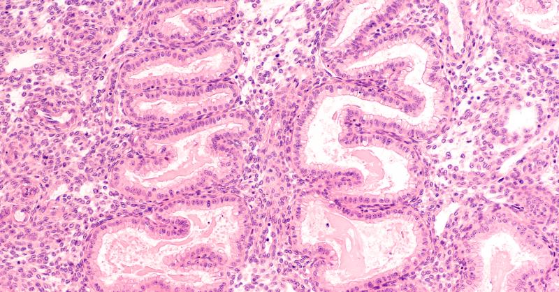 Is Endometrial thickness an accurate predictor for IVF