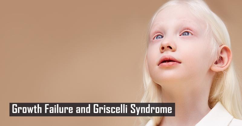 Endocrinopathies After Stem Cell Transplant in a Patient with Griscelli Syndrome