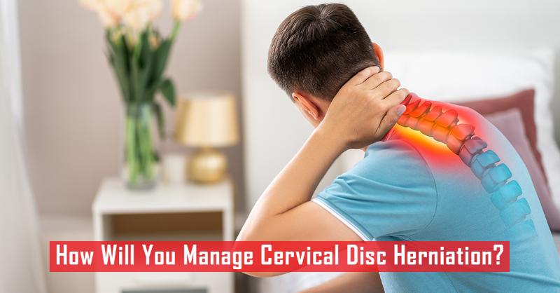 Management of Cervical Disc Herniation