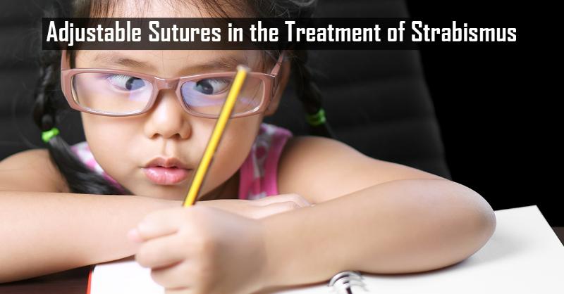 Significance of Adjustable Sutures in Strabismus Surgery