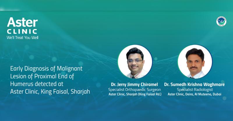<p>Early Diagnosis of Malignant Lesion of Proximal End of Humerus</p>