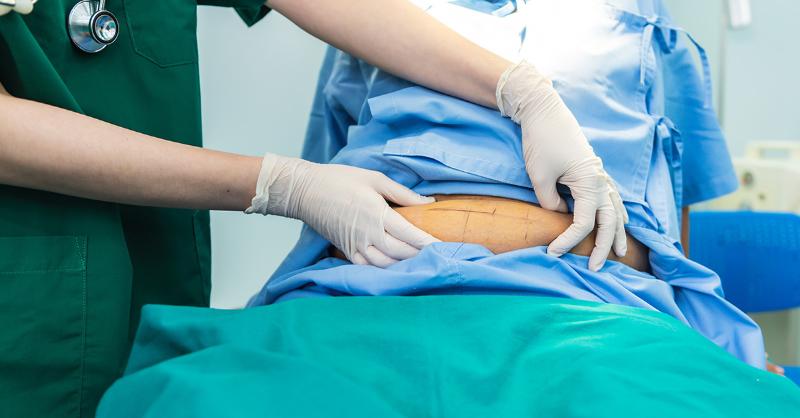 <p>The problem of Appetite Loss After Major Abdominal Surgery</p>