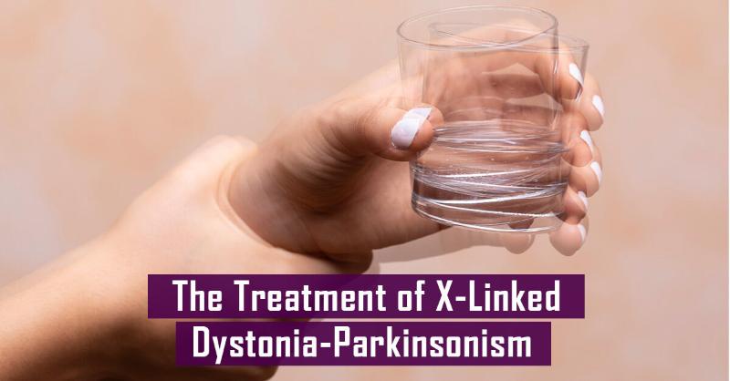 <p>Most Effective Treatment for X-linked Dystonia-Parkinsonism</p>