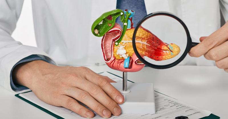 <p>Hypertriglyceridemia-induced Acute Pancreatitis: What would be your Therapeutic Preferences?&nbsp;</p>