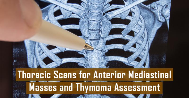 <p>Thymoma Staging and Diagnosis</p>