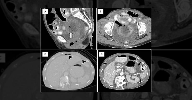 <p>Accurate Imaging Technique for the Diagnosis of Pyometra</p>
