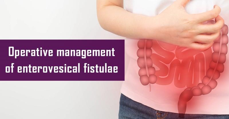 Managing Enterovesical Fistula