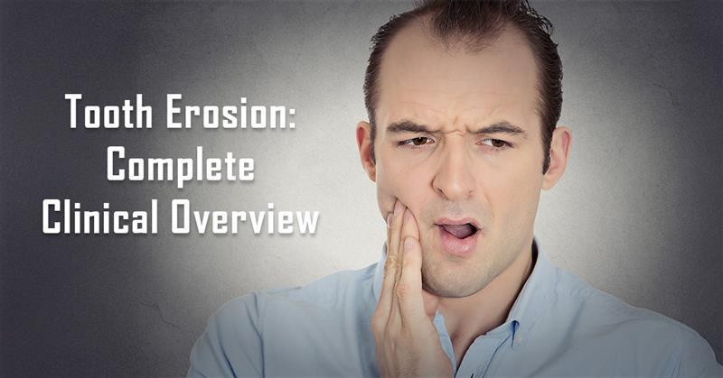 <div>Understanding Dental Erosion: A Complete Clinical Overview</div>