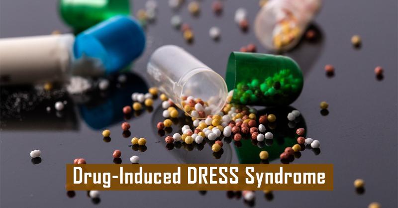 DRESS Syndrome Caused by Omeprazole: A Case Study