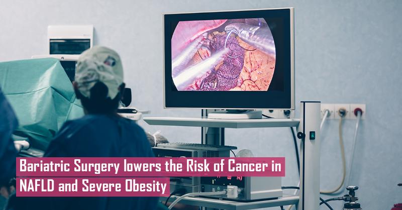 Bariatric surgery lowers the risk of cancer in nonalcoholic fatty liver disease and severe obesity