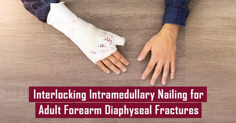 <p>InterlockingI Intramedullary Nail For Forearm Diaphyseal Fractures In Adults</p>
