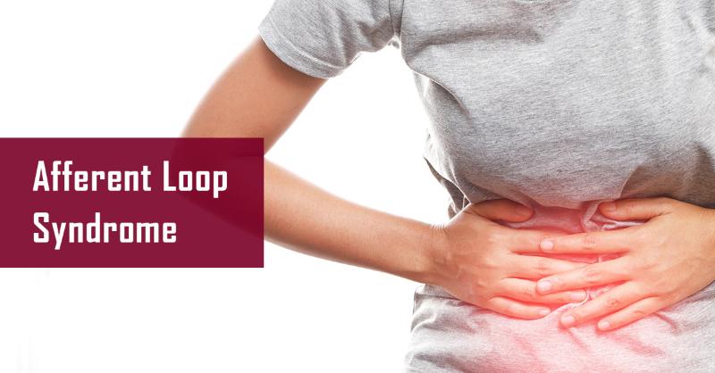 <p>Etiology of Afferent Loop Syndrome</p>