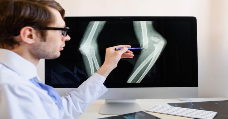 <p>Distal Humerus Bone Fracture: Need Your Approach on Management...</p>