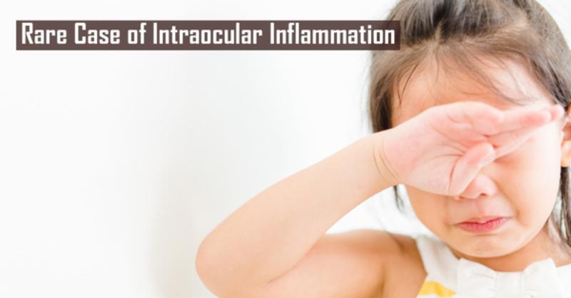Rare Case of Intraocular Inflammation after Two Surgical Interventions