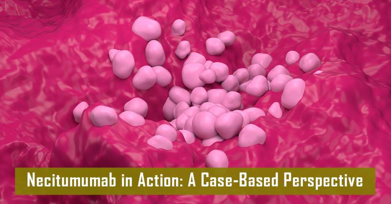 <div>A Case of Progression Control in Advanced Squamous NSCLC</div>