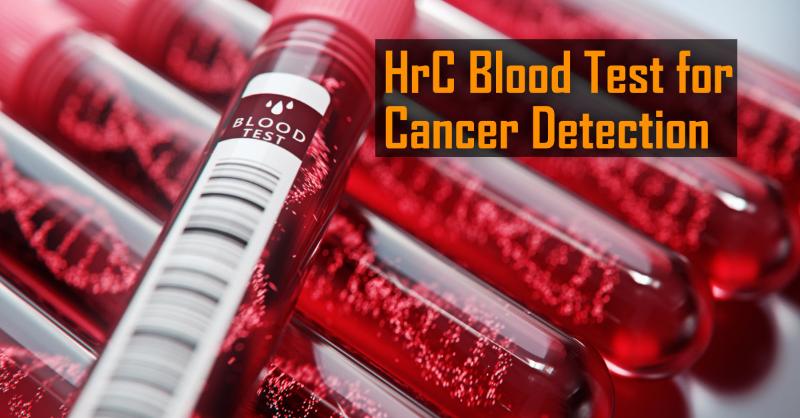 Biotech startups Tzar Labs and Epigeneres Biotechnology discover a novel blood test for cancer detection
