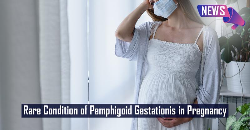 Pemphigoid Gestationis in a Pregnant woman 