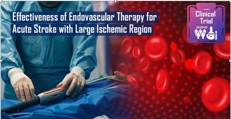 Endovascular Therapy for Acute Stroke with a Large Ischemic Region ...