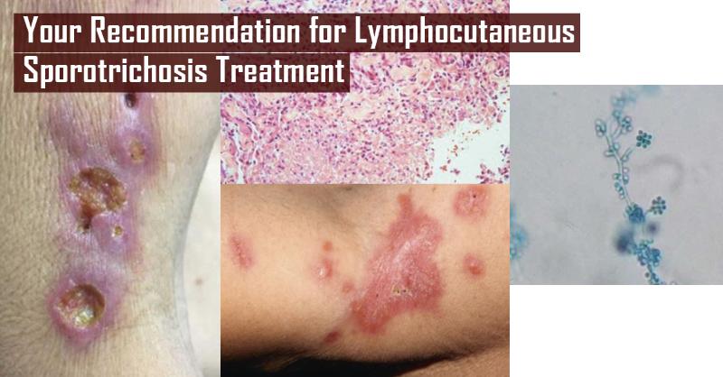 What Treatment Will You Recommend After Failure of First-Line Treatment?