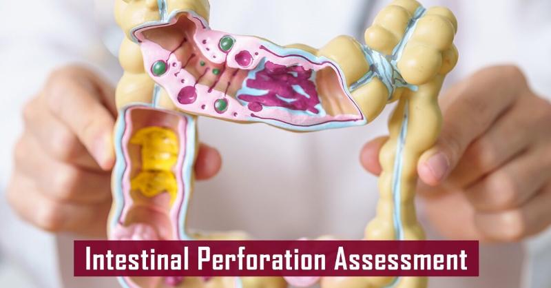 <p>Evaluation of Intestinal perforation</p>