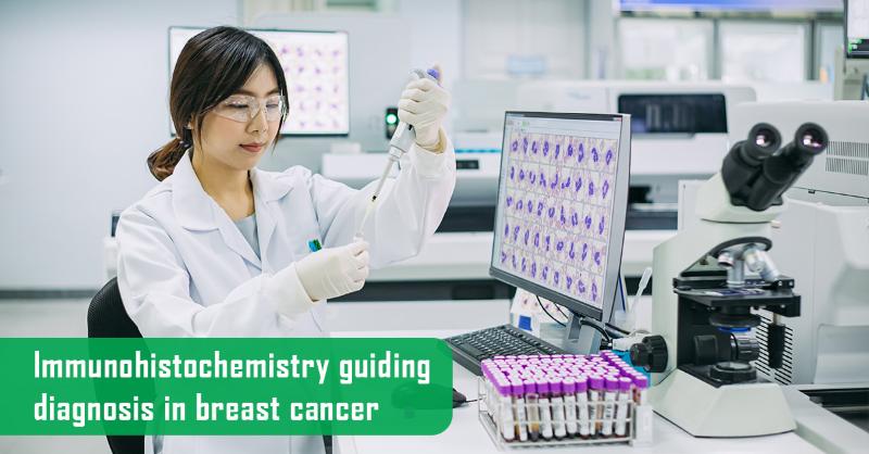 <div>Diagnostic Applications of IHC in Breast Cancer</div>